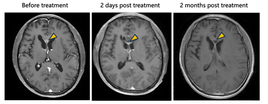 A close-up of a brain scan
AI-generated content may be incorrect.