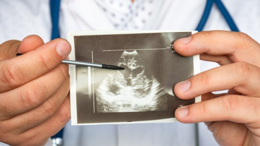 Pictured: Doctor points to a heart ultrasound/iSto