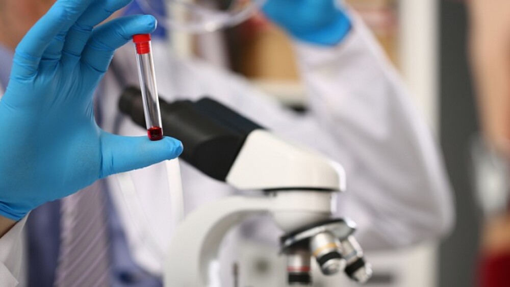 Male hand in blue protective gloves holding test tube with blood sample against background of microscope. Makes express analysis for aids in the presence of patient in hospice chemical laboratory