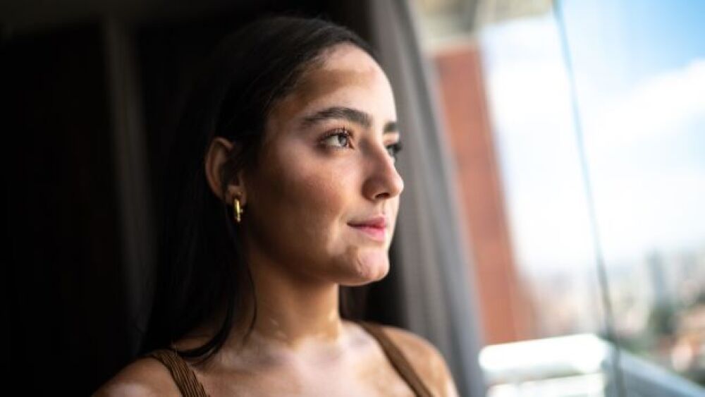 Opzelura is the newest drug for repigmentation the