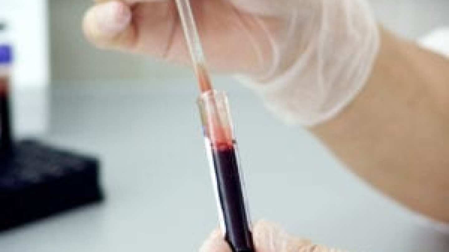 proper blood storage and preservation