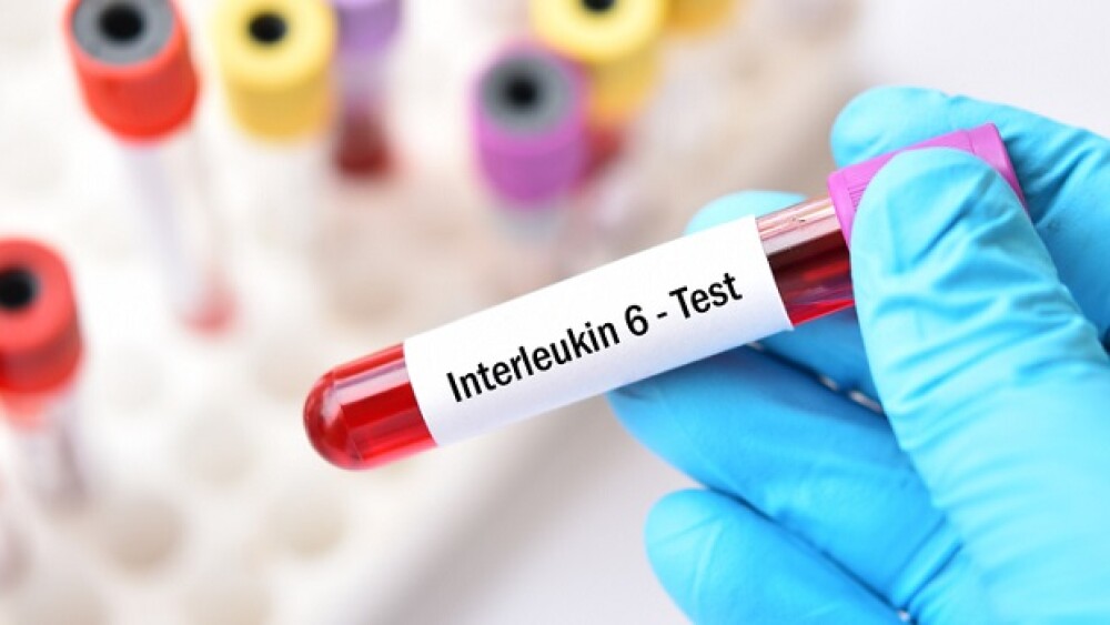 Blood sample tube for interleukin 6 or IL-6 test, Pro-inflammatory cytokine and anti-inflammatory myokine