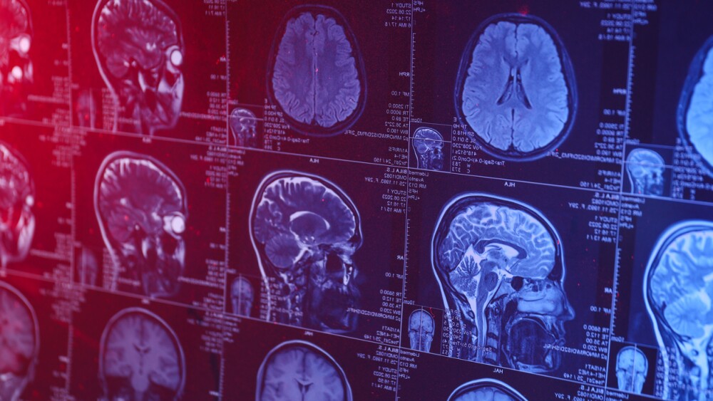 MRI or magnetic resonance imaging of the head and brain. Close up