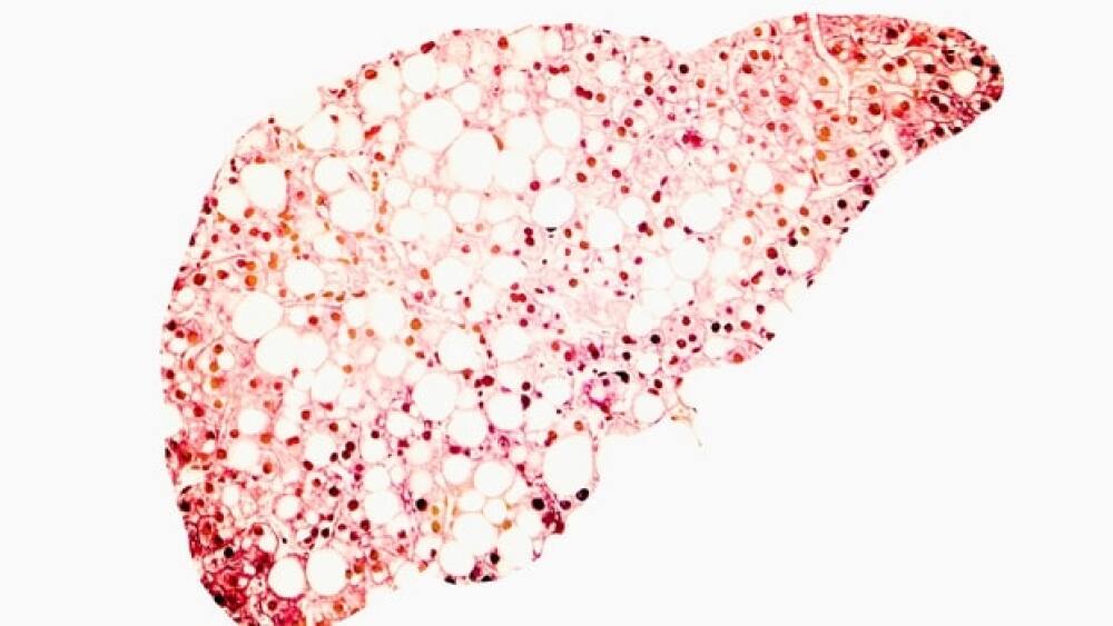 Courtesy of Getty Images