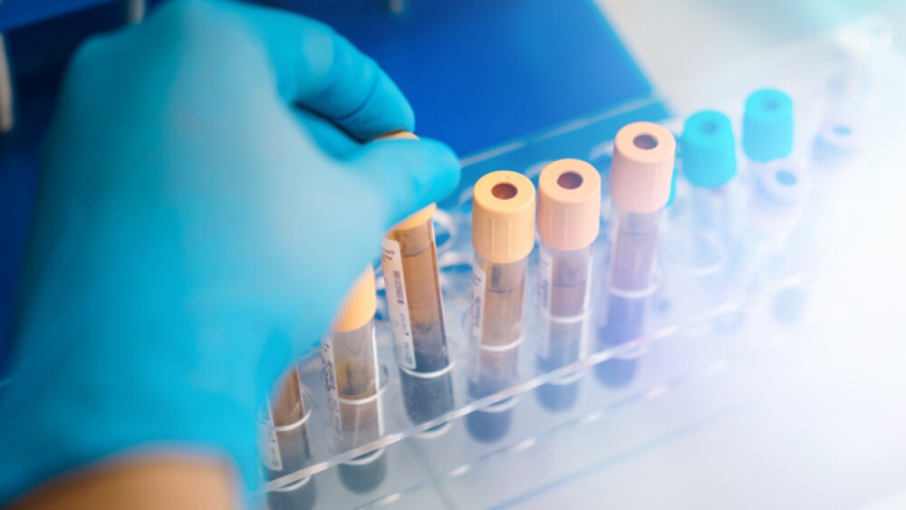 Rack with tubes blood samples from patients for analysis in the hematology lab .
