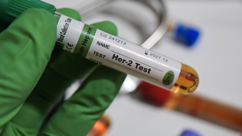 Labcorp to Offer HPV and STI Self-Collection Options in Labcorp Patient ...