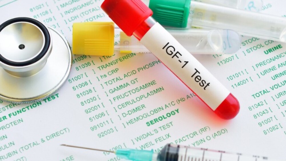 Pictured: Blood sample for insulin-like growth fac
