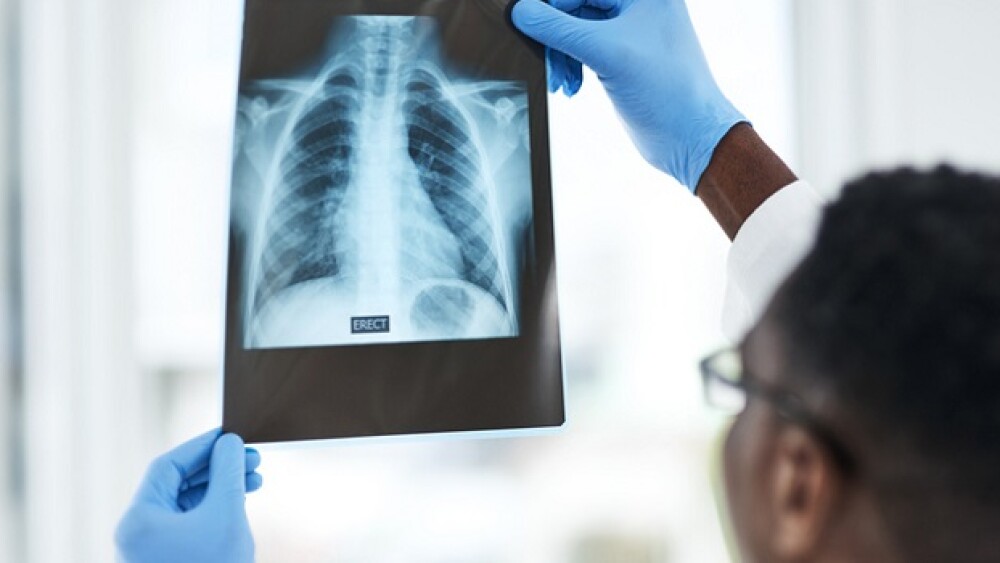 Shot of a young doctor analysing an x ray of a patient’s chest