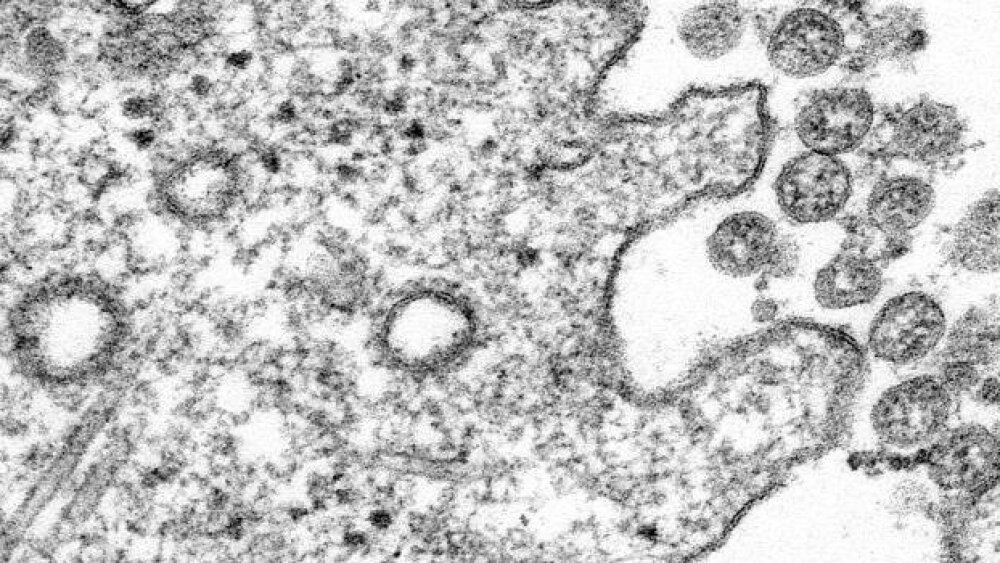 Cynthia S. Goldsmith and A. Tamin/CDC