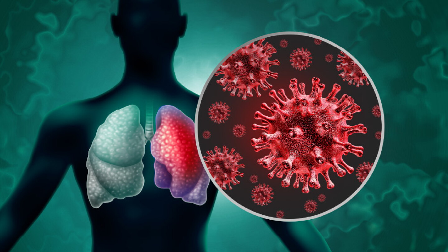 Advances in RSV Vaccine Research and Development - BioSpace