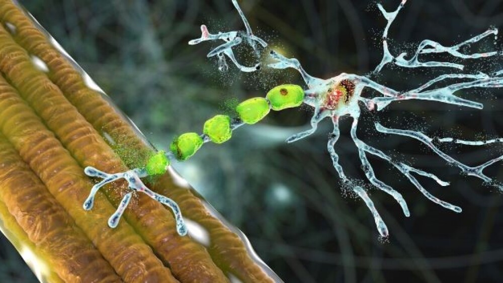 Pictured: Illustration of a motor neuron being deg