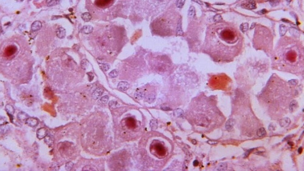 Pictured: Photomicrograph of a Lendrum-stained kid