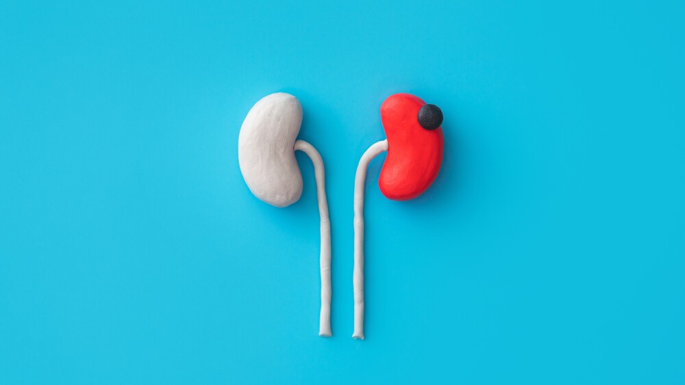 concept - kidney tumor.