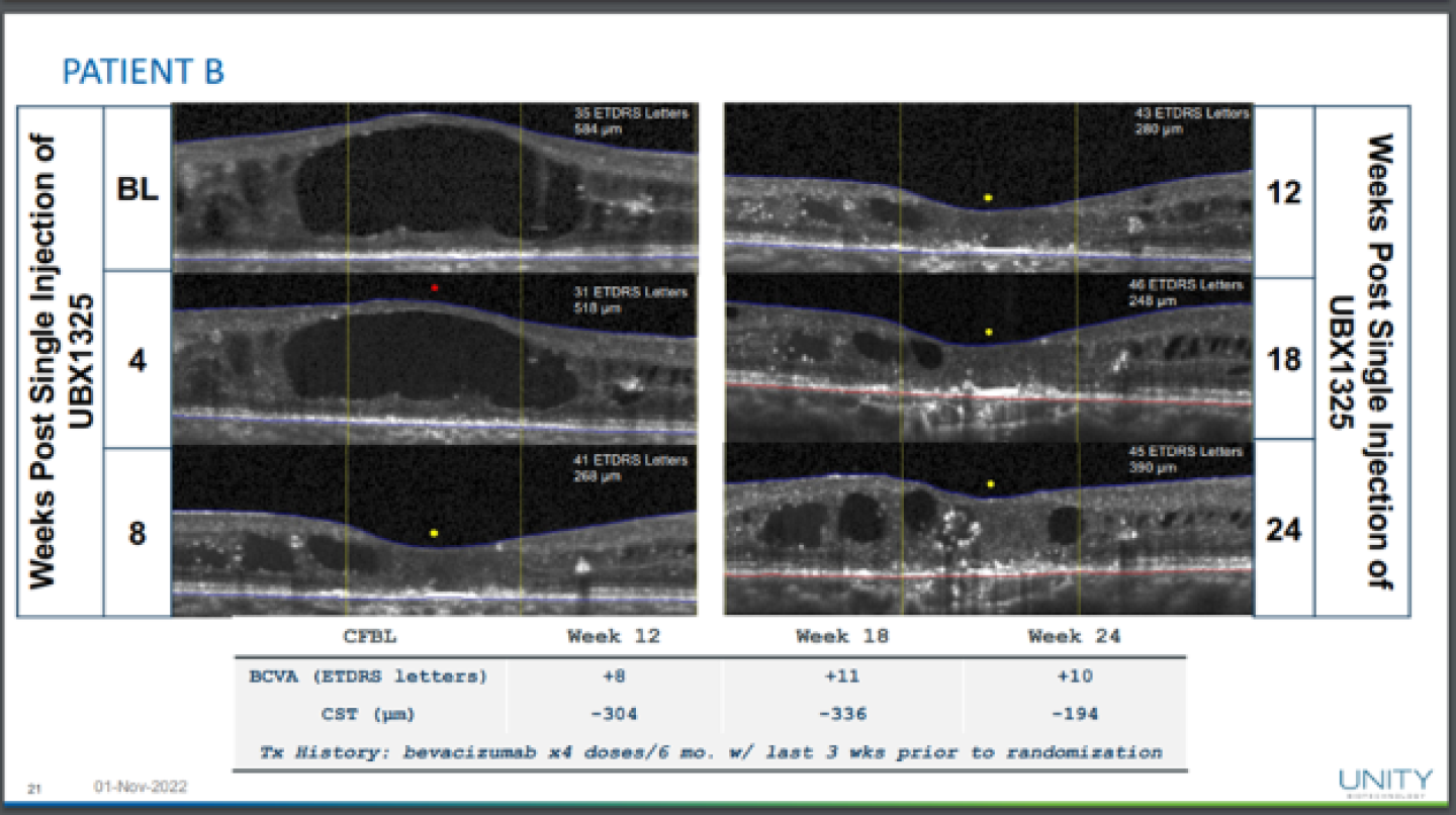 Retinal imagery from Unity's Phase II DME study showing structural improvements/courtesy of Unity Biotechnology