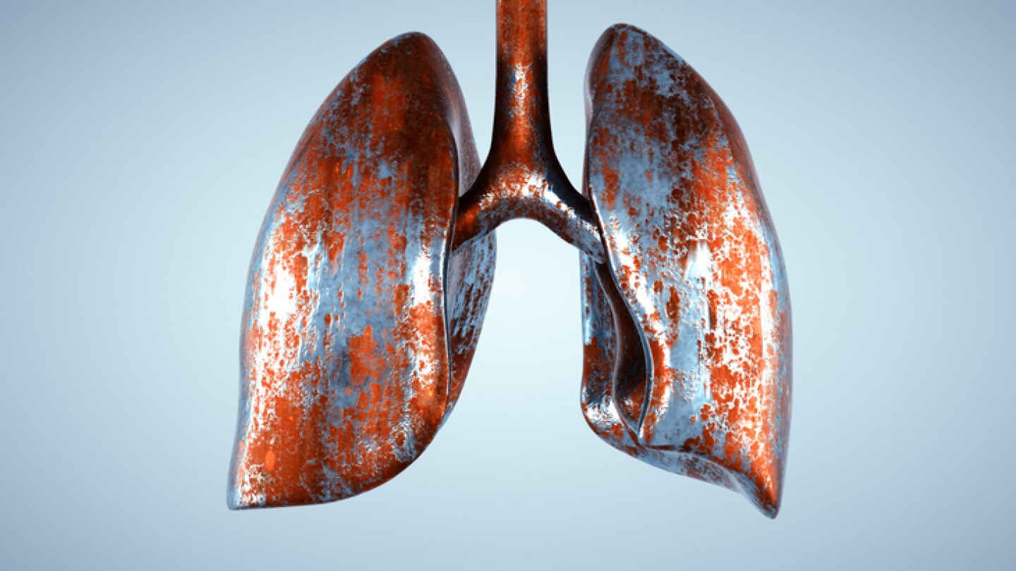 Rusty lung. Cancer and health concept. This is a 3d render illustration.