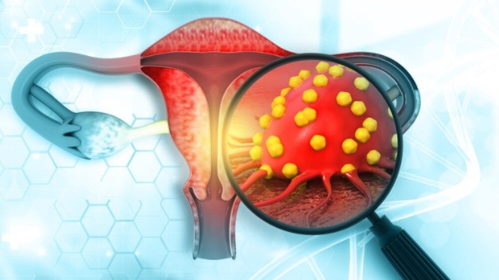Pictured: Magnifying glass focusing on a tumor in