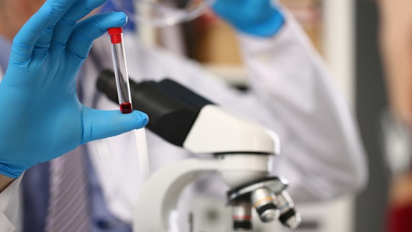 Male hand in blue protective gloves holding test tube with blood sample against background of microscope. Makes express analysis for aids in the presence of patient in hospice chemical laboratory