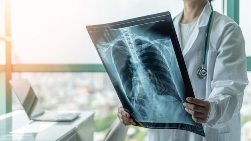 Pictured: A doctor holds a chest x-ray/courtesy of