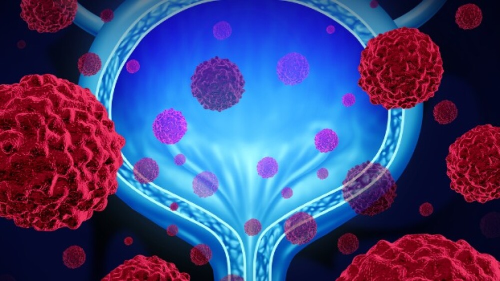 Pictured: 3D concept art showing a bladder surrounded by cancer cells