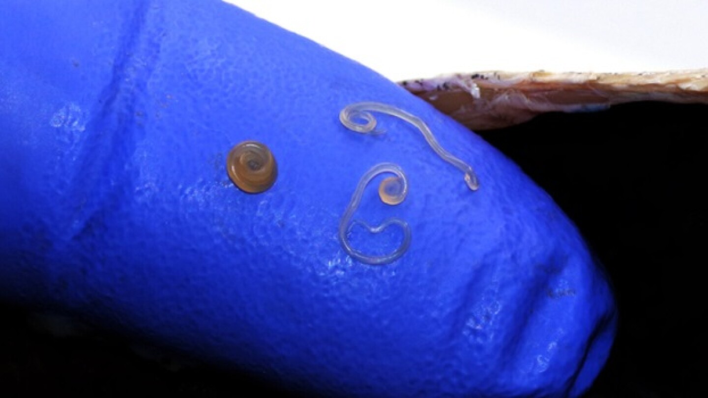 Anisakis nematode worms on the finger of a doctor's or veterinarian's glove