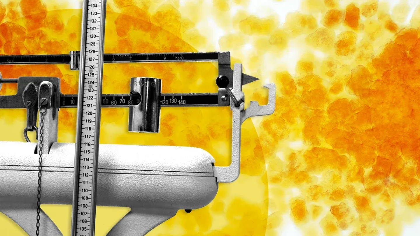 A scale and fat cells