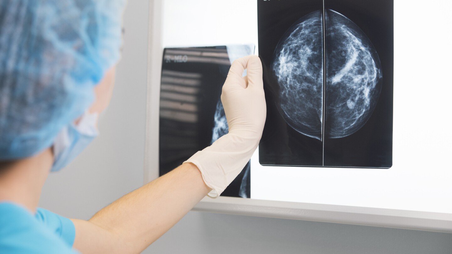 Woman doctor in surgery outfit looking at a mammogram