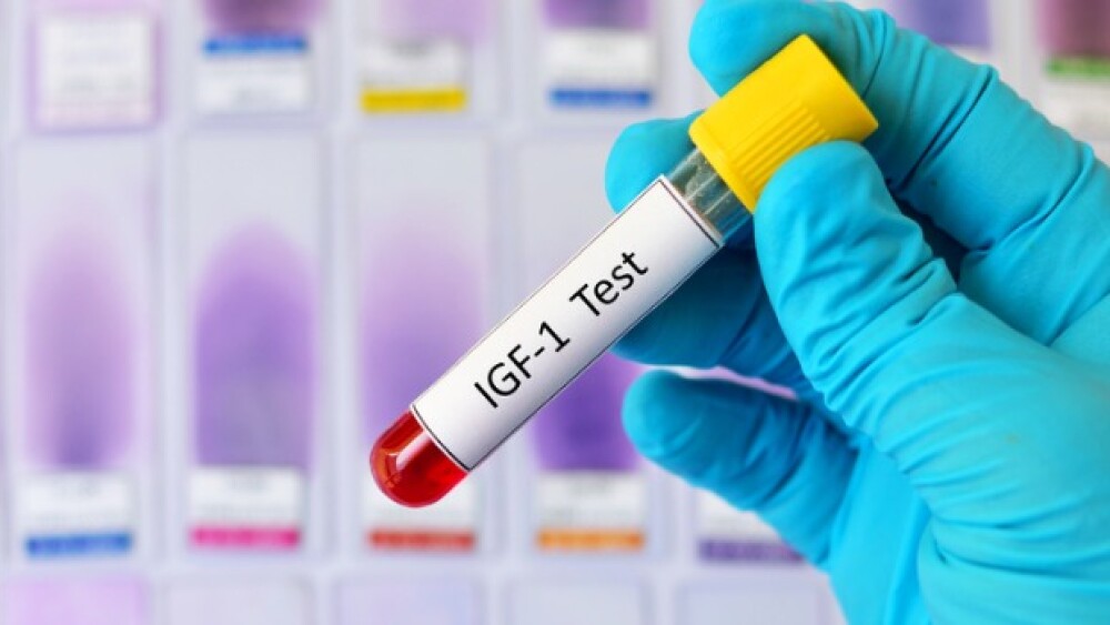 Pictured: Test-tube containing a patient's sample