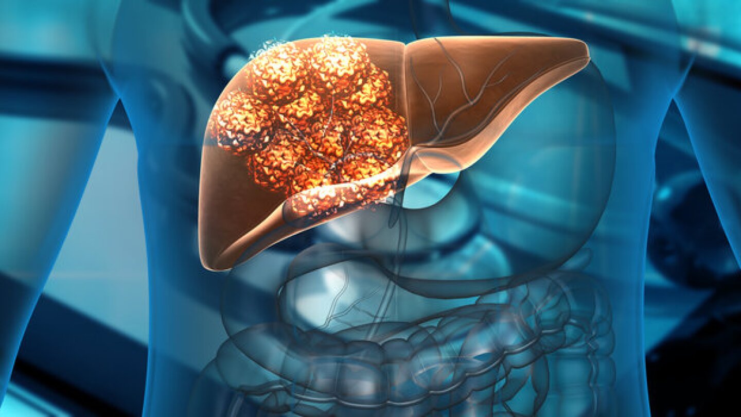 Pictured: Cancer cells growing on the liver/iStock