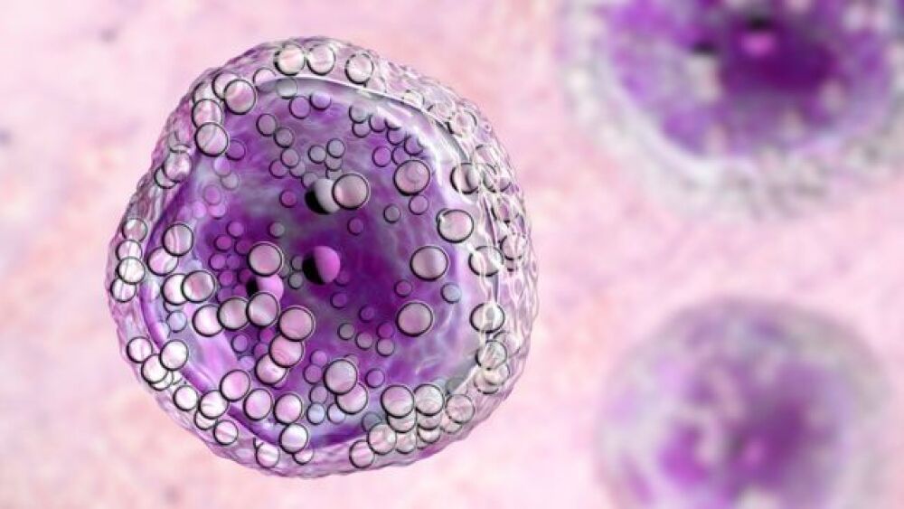 Pictured: Illustration of a lymphoma cell/iStock,