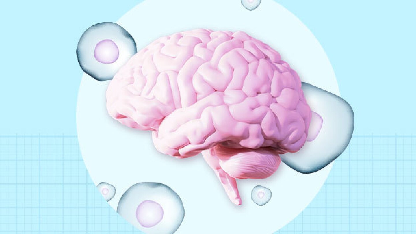 Pictured: Collage of a brain and stem cells/Taylor