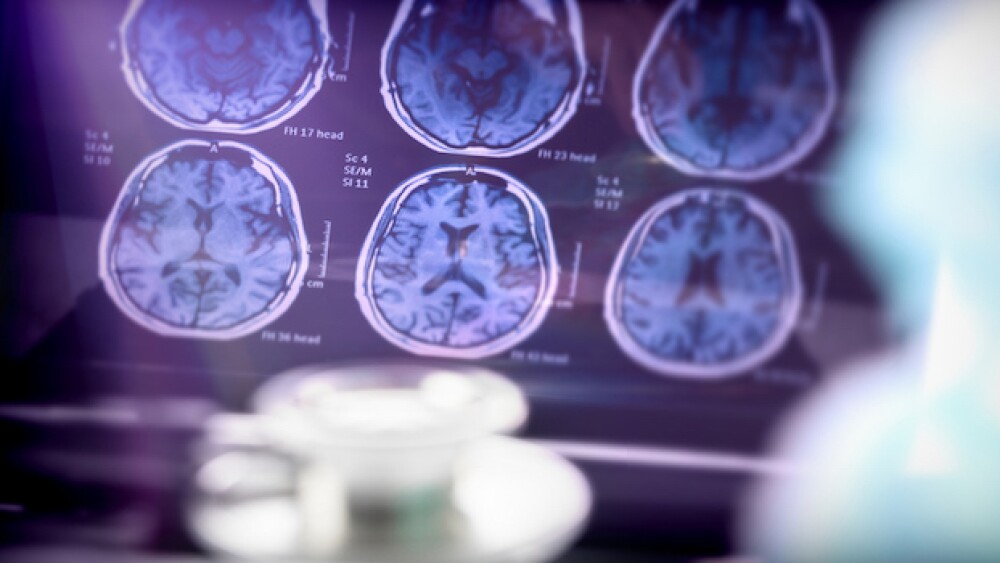 A scientific analysis of Alzheimer's disease/istoc