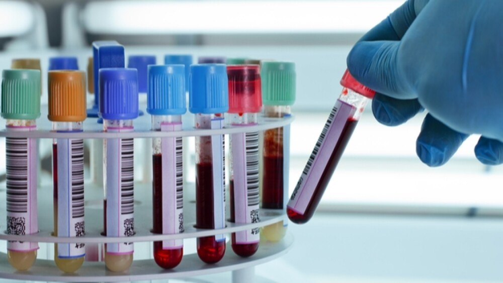 Stanford serology test is finally here.