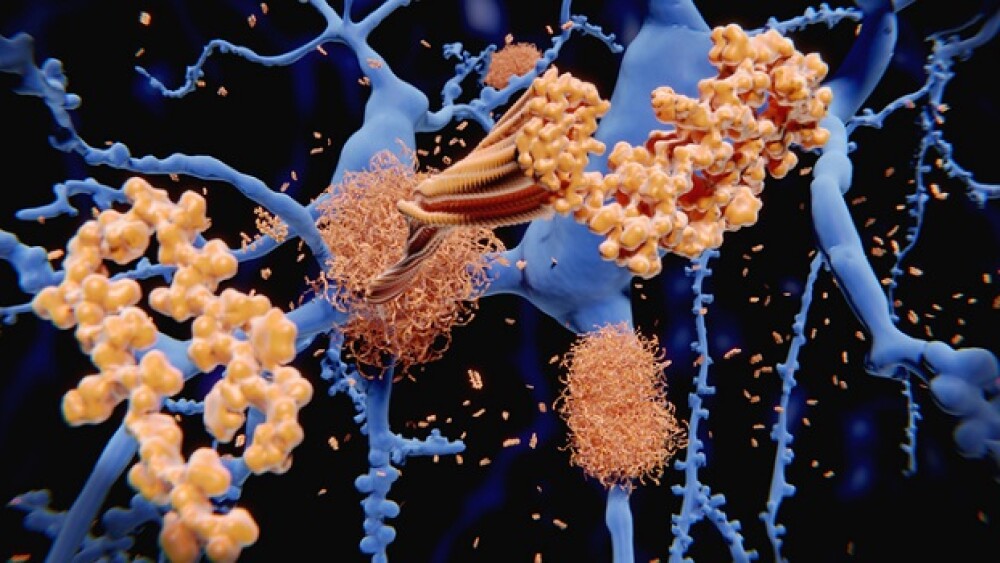 Pictured: 3D rendering of amyloid-beta oligomers