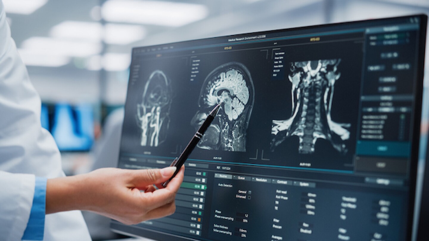 Neurosurgeon analyzes an MRI, iStock, gorodenkoff