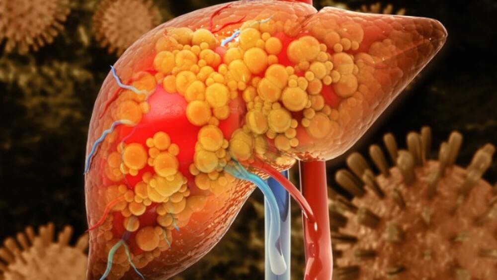 Pictured: Illustration of a damaged liver/iStock,