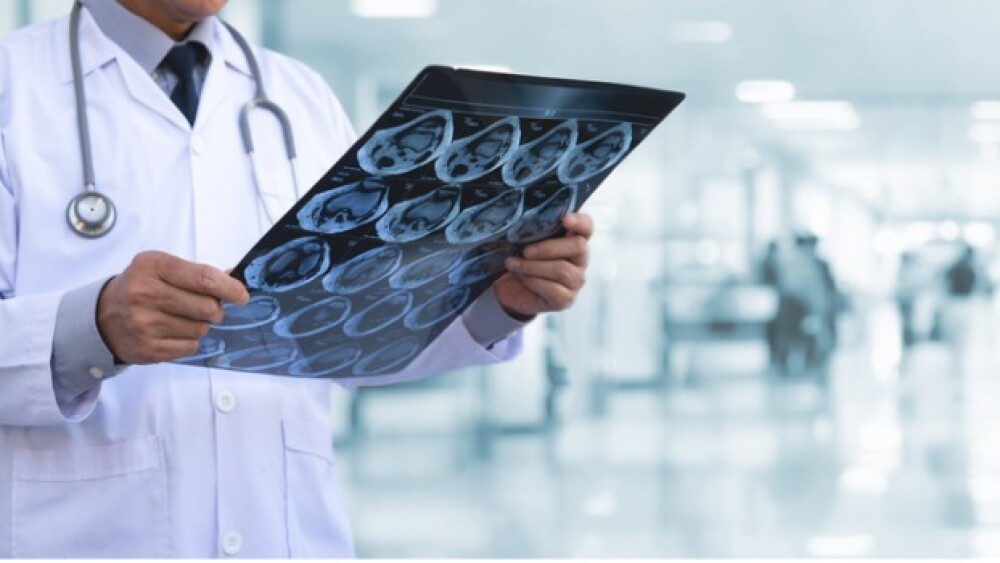 Pictured: Doctor looking at brain scan images/iSto