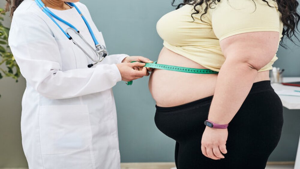 Pictured: Doctor measures waistline of obese patie
