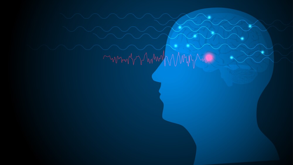 Focal seizure. Vector illustration of human brain and electroencephalograhy or EEG originating from temporal lobe.
