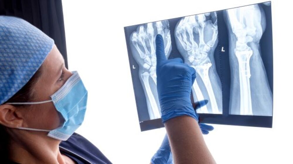Pictured: Healthcare worker examining a hand X-ray