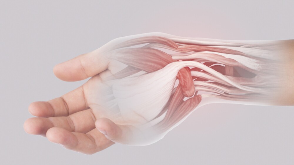 x-ray wrist muscle pain in gray background