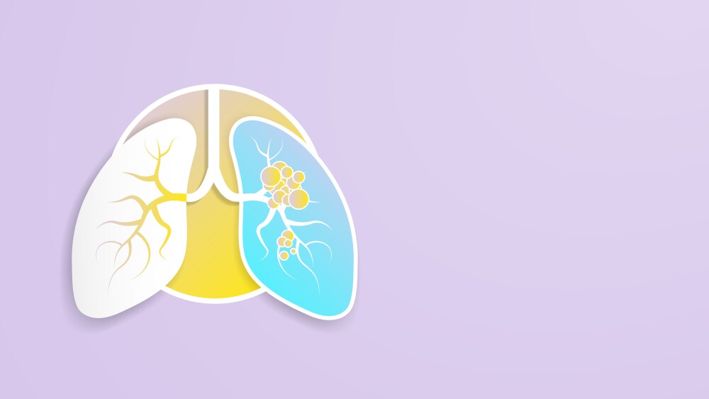 3D Paper Cut Pair of Lung dotted with yellow tumor bacteria infection spread across on a blue background with no text. Yellow dots as virus infection in the lungs. Vector Illustration.