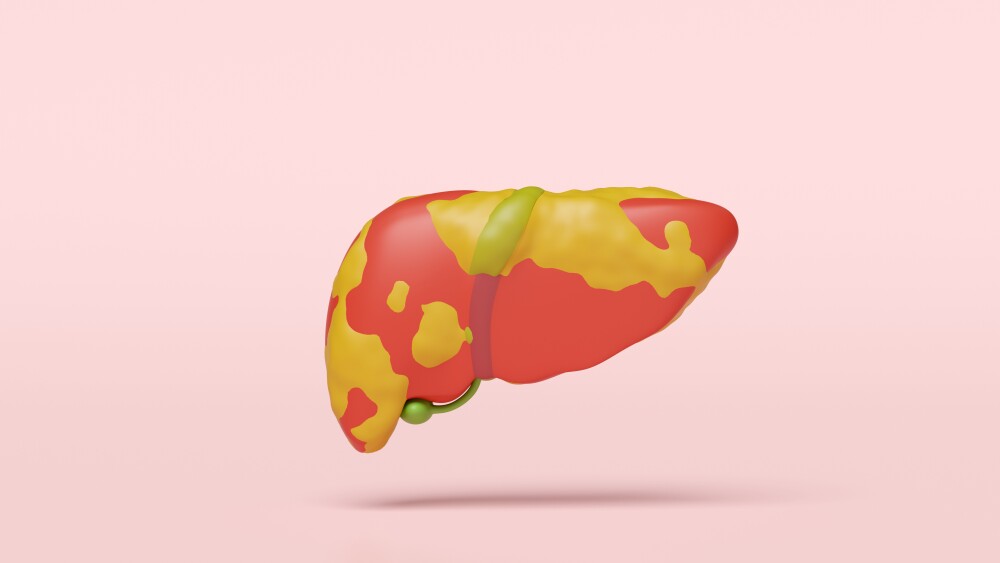 3d fatty liver disease isolated on pink background. 3d illustration render