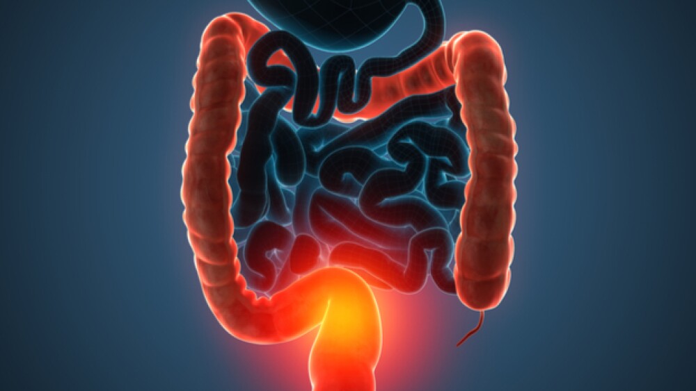 Zeposia recieved top line results in the ulcerativ