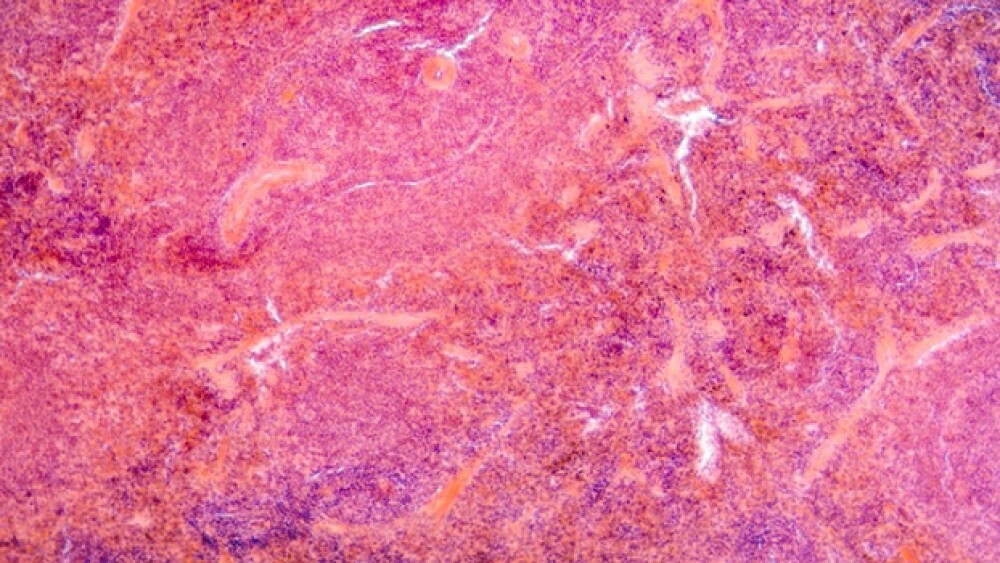 micrograph of pancreas tissue, typical pancreatic tissue in the jejunum tissue