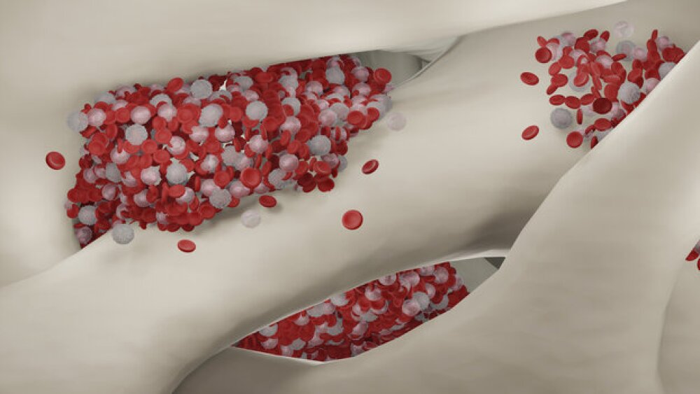 3D illustration of blood cells being produced in the bone marrow