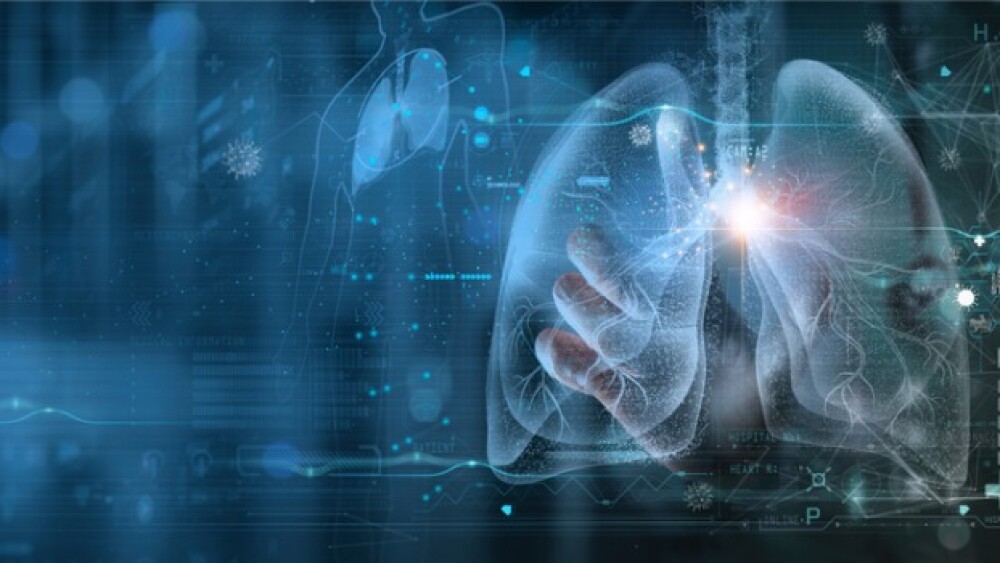 Pictured: Doctor diagnosing lungs on screen/iStock