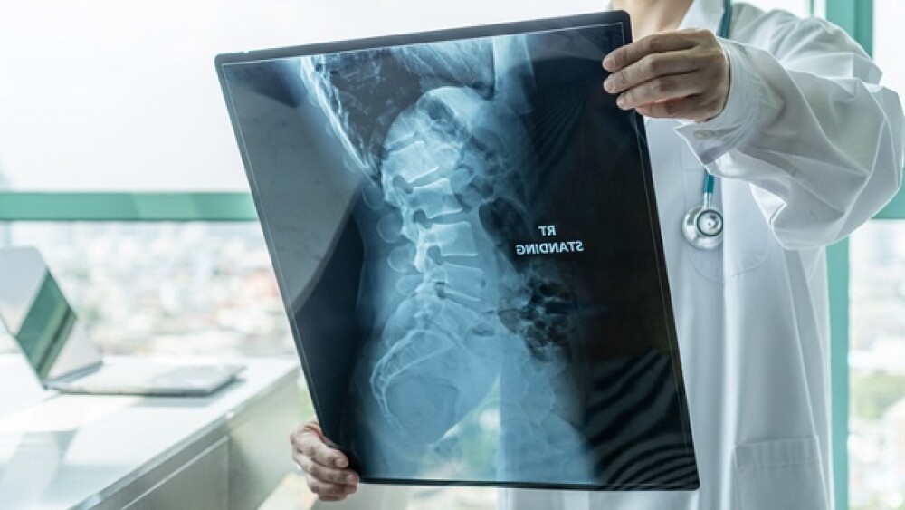 Surgical doctor looking at radiological spinal x-ray film for medical diagnosis on patient health on spine disease, bone cancer illness, spinal muscular atrophy, medical healthcare concept