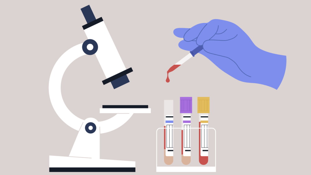 A gloved hand carefully collecting blood from a test tube while a microscope stands nearby, showcasing the intricate process of conducting lab blood tests for health analysis