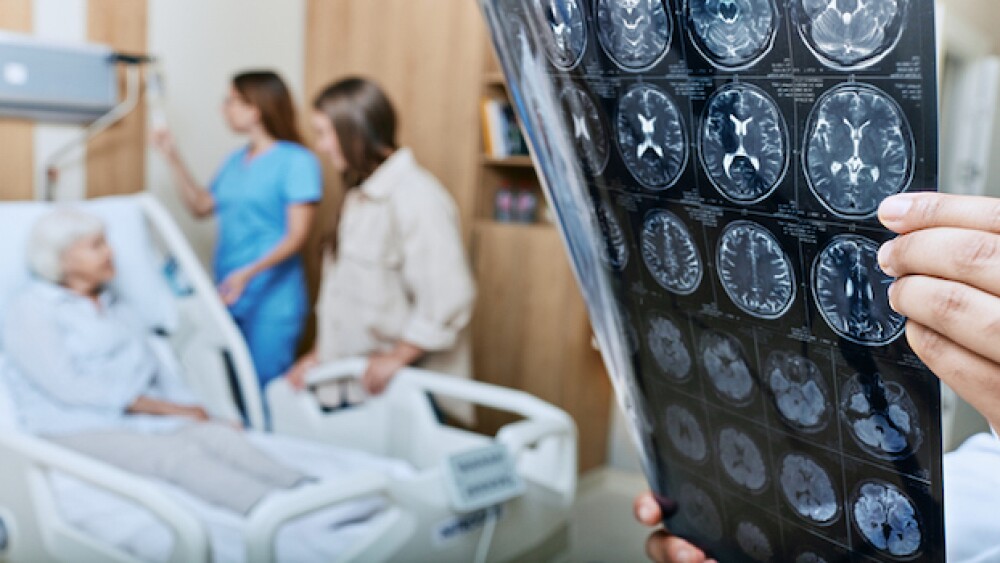 Pictured: Doctor holding a brain scan with an elde