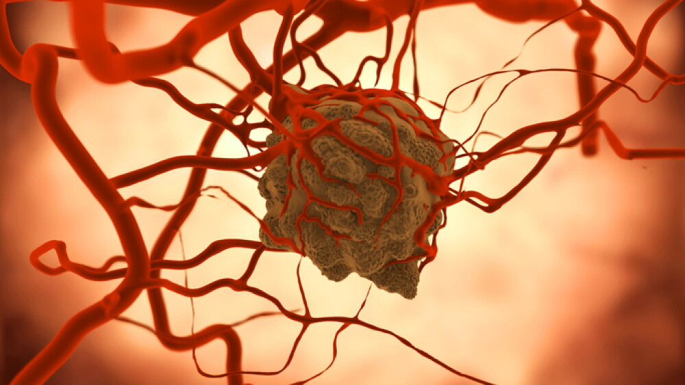 Tumor with increased vascularisation